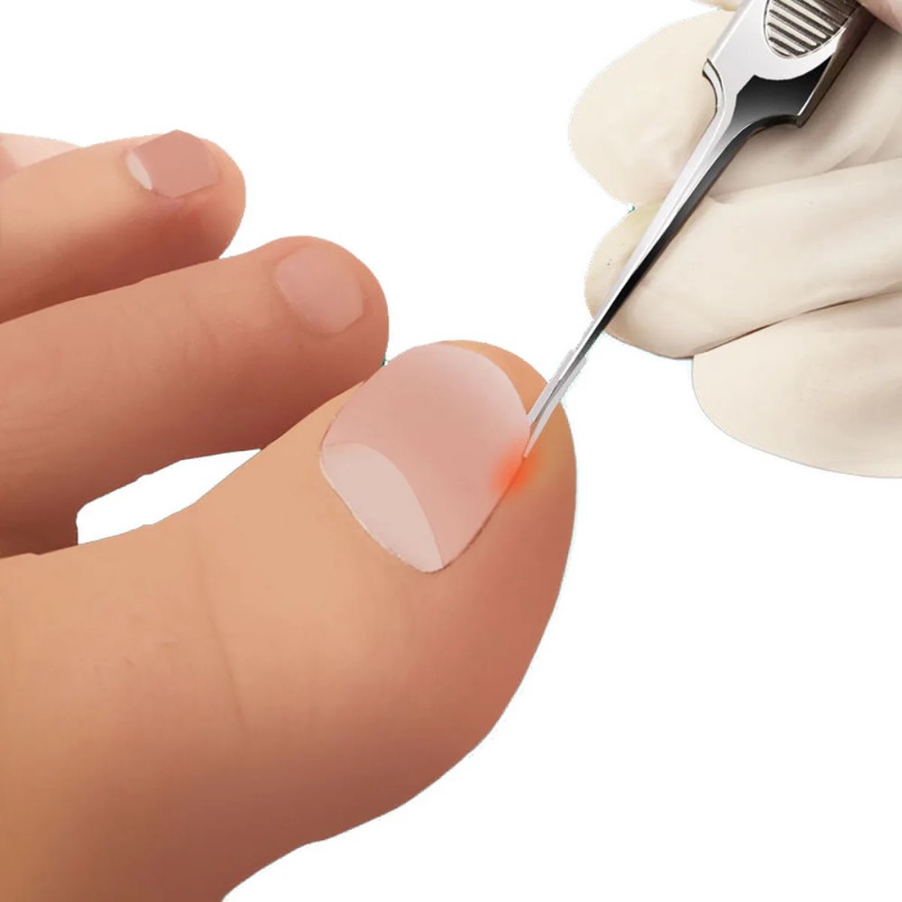 New Elastic C-shaped Nail Groo - Tools & Workshop Equipment For Sale In Hampshire Page 3 50 Gumtree recension och pris